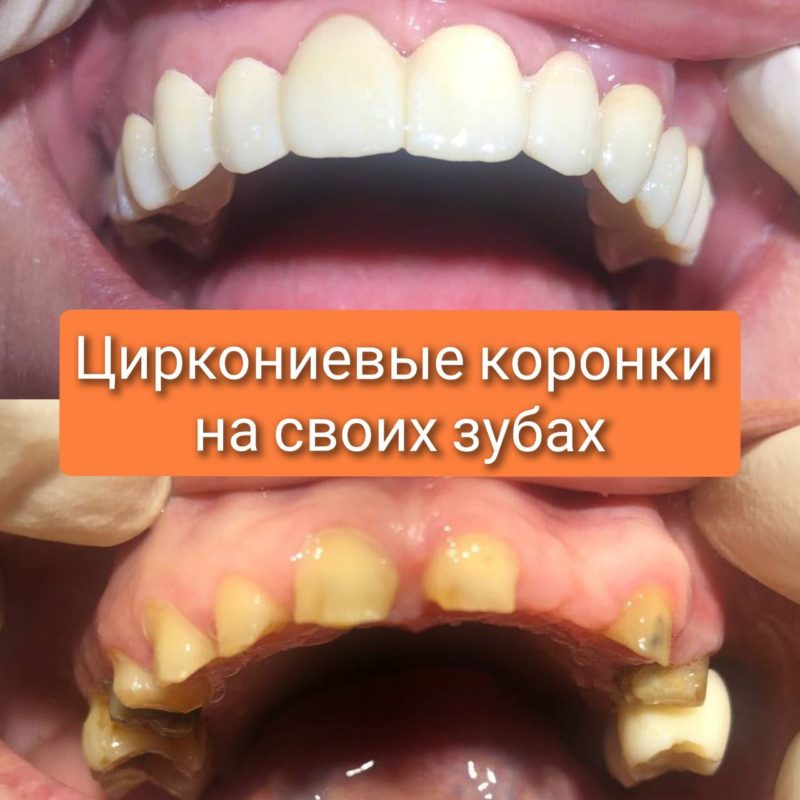 5192876767130536798