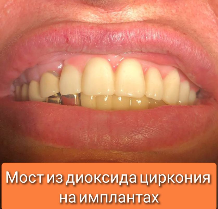 5199895649930305960
