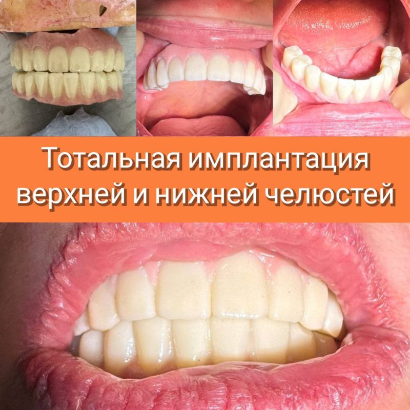 5208540040412653978