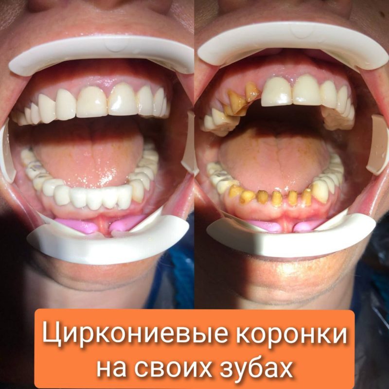 5208777315880914403