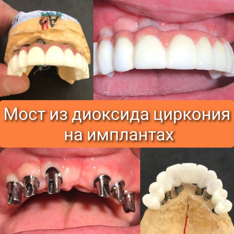 5213463245459935697