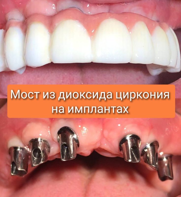 5224596255957699052
