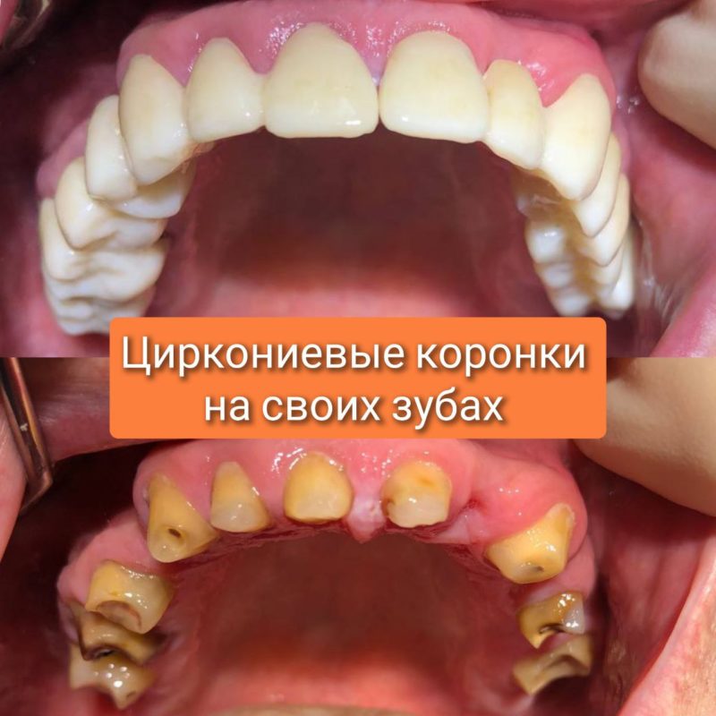 5231043869452389132