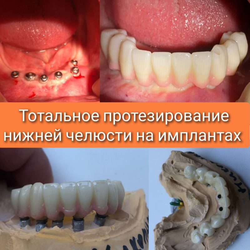 5240279672636430399