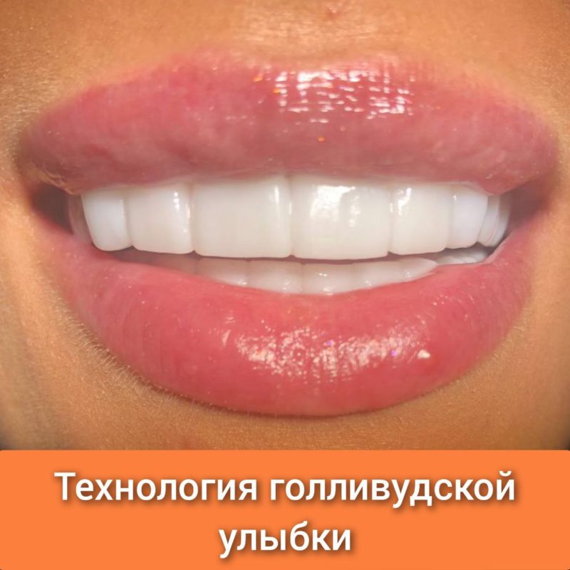 5260273570033032171