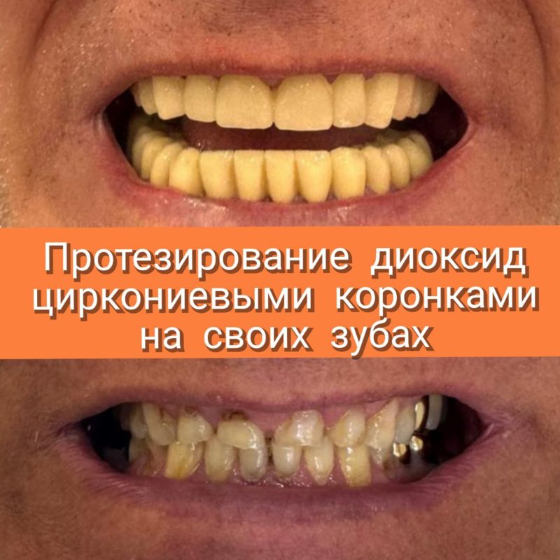 5262996751097392526 (1)
