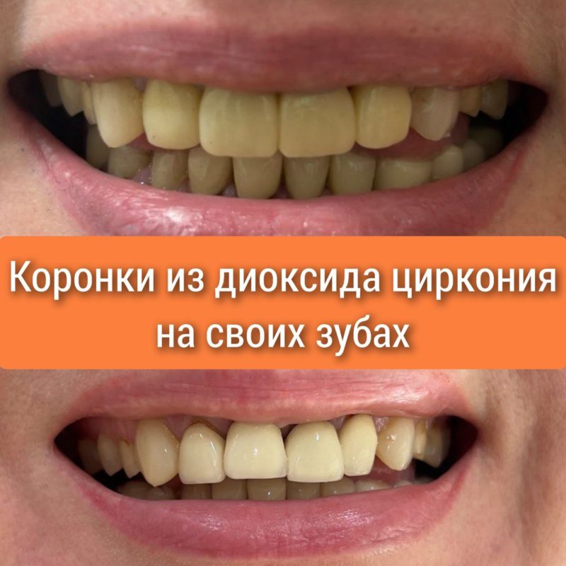 5307817749898191082