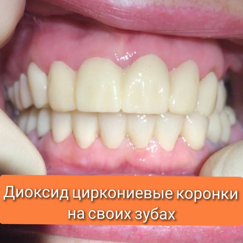 5321063214290684834