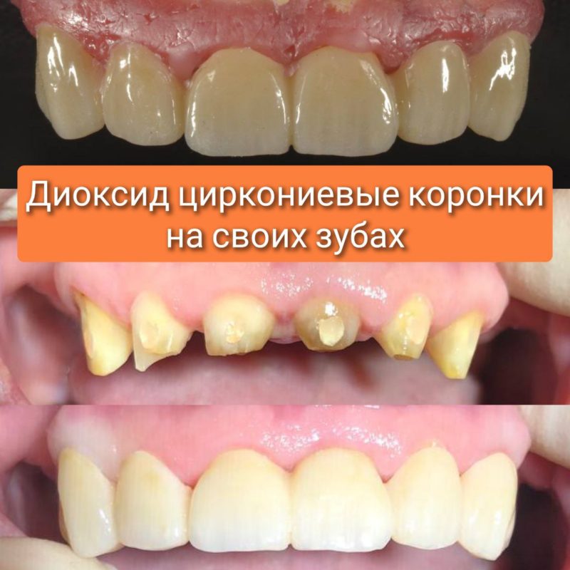 5445190874406441757