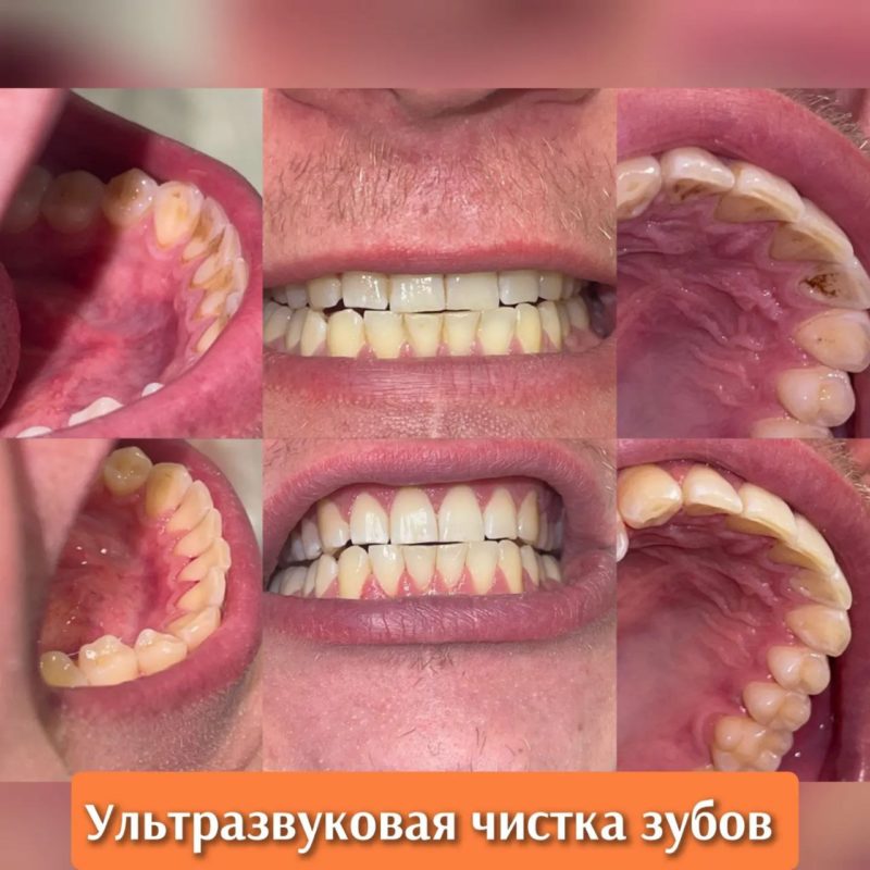 photo1676392329